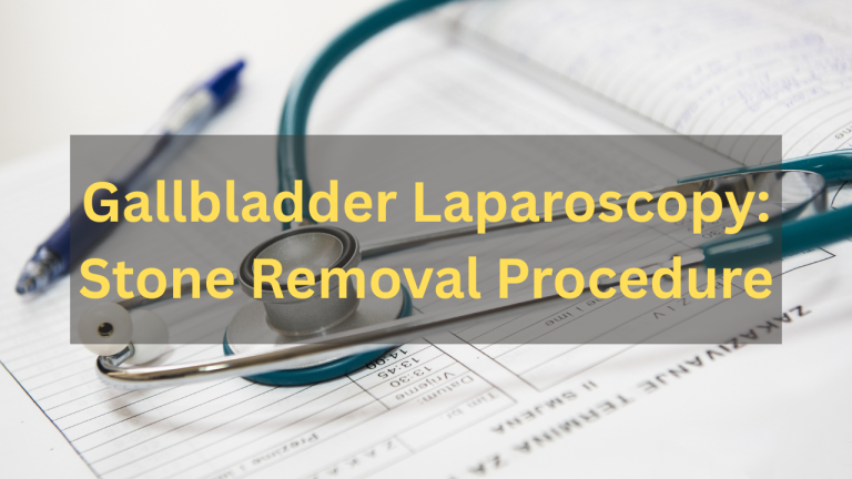 Gallbladder Laparoscopy: Stone Removal Procedure